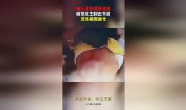 缅北医生爆料视频播放网站,视频播放网站背后的惊人真相